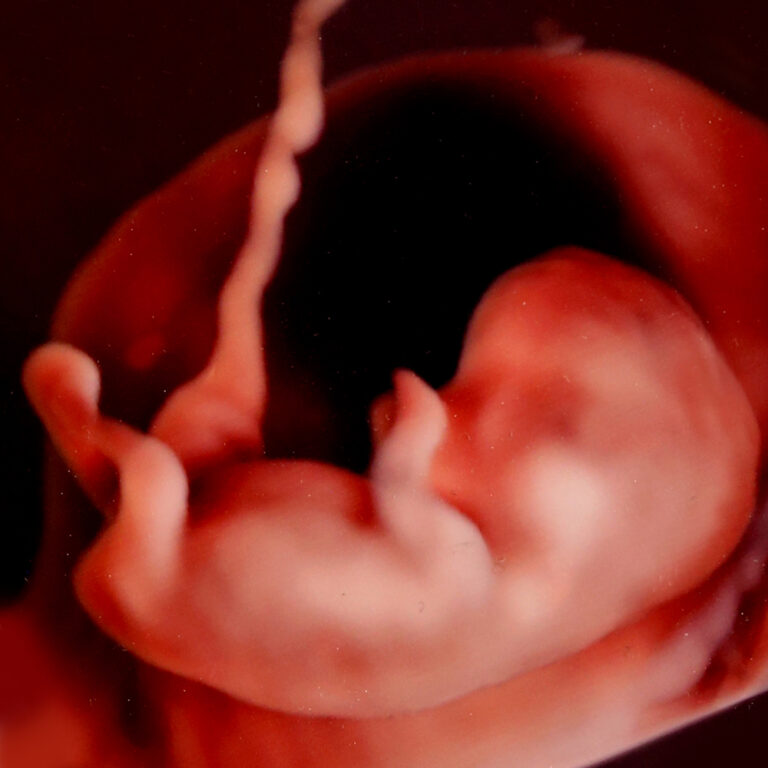 Schwangerschaftsmedizin